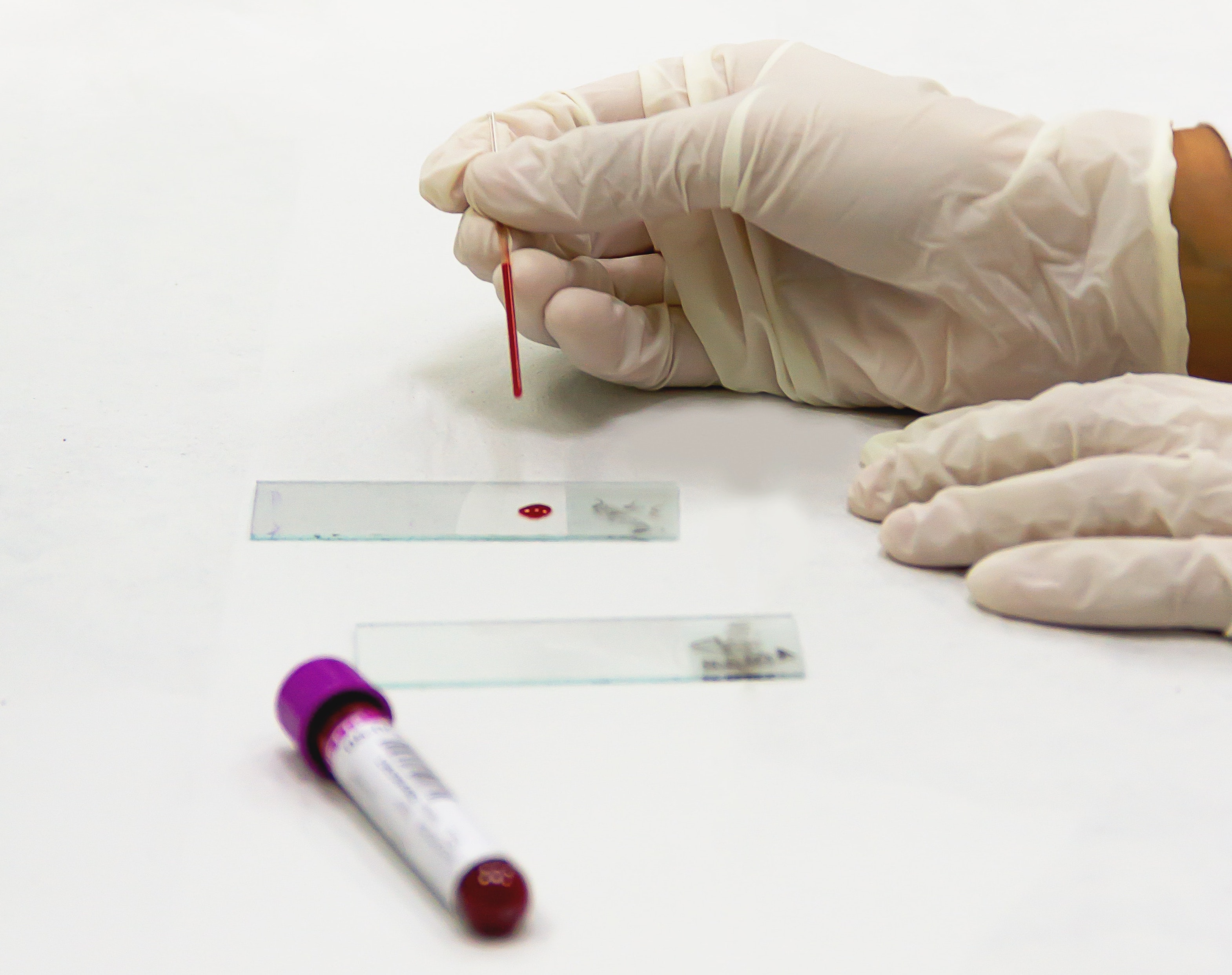 Clinical Test - Private Blood Test